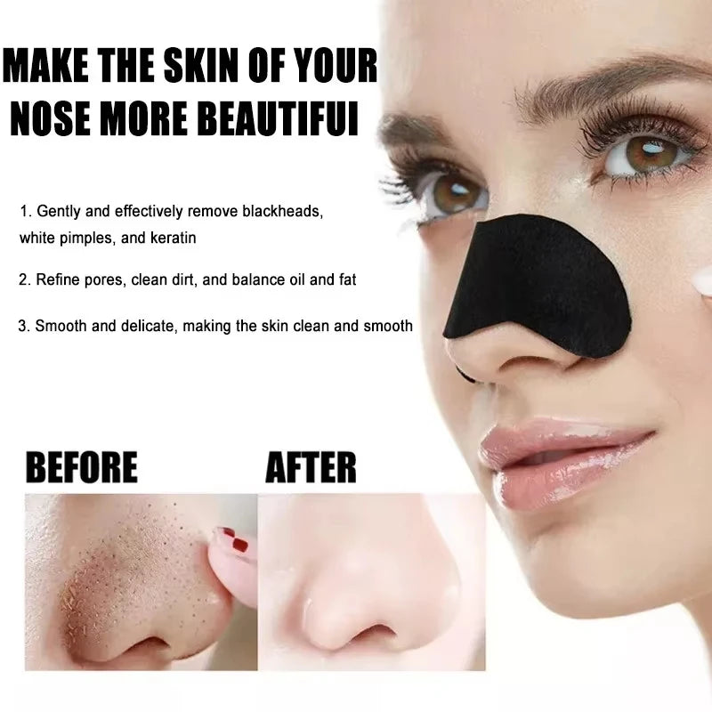 10/50/100 Pieces Blackhead Remover Patches Deep Cleansing - Effective Facial Cleansing to Absorb Facial Blackheads and Pores