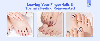 Nail Fungus Treatment LED Laser Device for Cleaning Onychomycosis USB Charge 905nm Infrared Light 470nm Blue Light Nail Salon