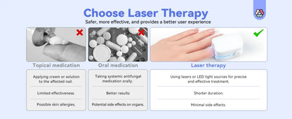 Nail Fungus Treatment LED Laser Device for Cleaning Onychomycosis USB Charge 905nm Infrared Light 470nm Blue Light Nail Salon