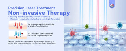 Nail Fungus Treatment LED Laser Device for Cleaning Onychomycosis USB Charge 905nm Infrared Light 470nm Blue Light Nail Salon